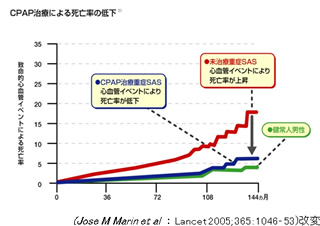 Q&A 高血圧の他にSASを放置していると怖い合併症はありますか？